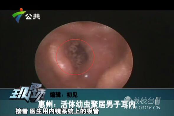 �@�֣����Ӷ����L�M��ɫ���x��˺ҧ����ʹ��������