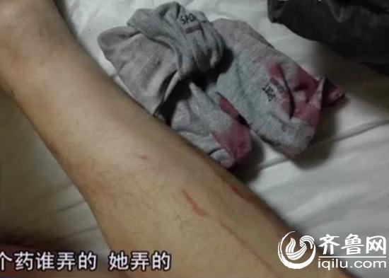 小伙手指斷裂身中“百草枯” 或因前女友報復